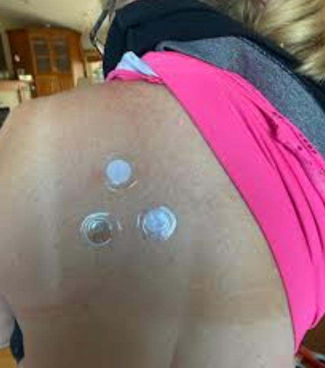 Icewave Phototherapy patches from Lifewave for Pain relief and reduced inflammation